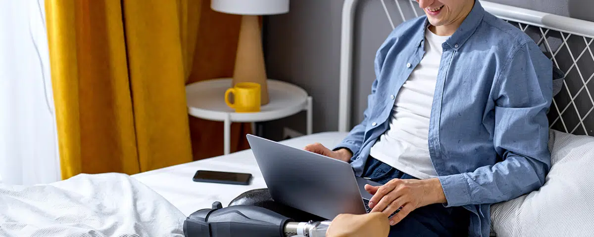 man with prosthetic legs sitting on bed with laptop