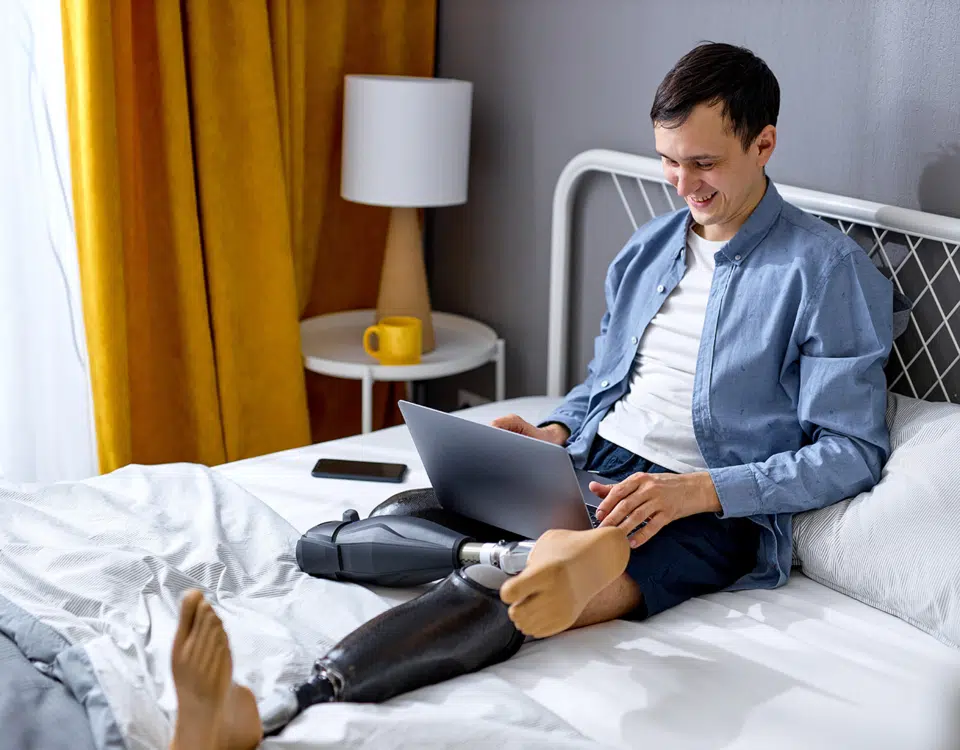 man with prosthetic legs sitting on bed with laptop